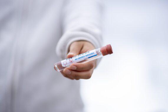 test tube 5065426 flipped scaled